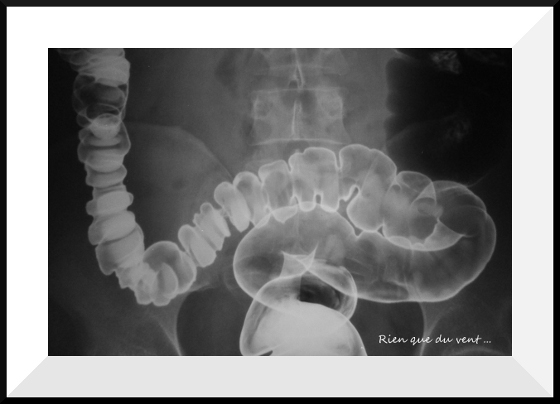 Ventilation suprême ...